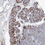 SLC25A29 Antibody in Immunohistochemistry (Paraffin) (IHC (P))