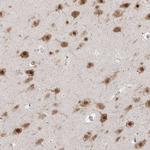 NeuN Antibody in Immunohistochemistry (Paraffin) (IHC (P))