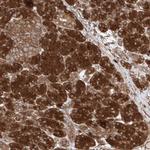 YKT6 Antibody in Immunohistochemistry (Paraffin) (IHC (P))