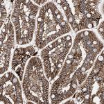 ATP11C Antibody in Immunohistochemistry (Paraffin) (IHC (P))