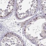 NCAM2 Antibody in Immunohistochemistry (Paraffin) (IHC (P))