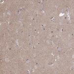 NCAM2 Antibody in Immunohistochemistry (IHC)