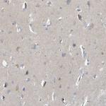 VTA1 Antibody in Immunohistochemistry (Paraffin) (IHC (P))