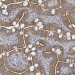 VTA1 Antibody in Immunohistochemistry (Paraffin) (IHC (P))