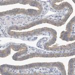 VTA1 Antibody in Immunohistochemistry (Paraffin) (IHC (P))