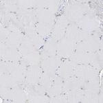 GALNTL6 Antibody in Immunohistochemistry (Paraffin) (IHC (P))