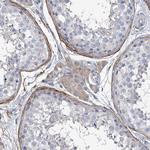 GALNTL6 Antibody in Immunohistochemistry (Paraffin) (IHC (P))