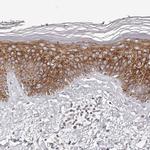 Kir6.1 (KCNJ8) Antibody in Immunohistochemistry (IHC)