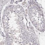 Kir6.1 (KCNJ8) Antibody in Immunohistochemistry (IHC)