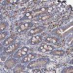 PCSK5 Antibody in Immunohistochemistry (Paraffin) (IHC (P))