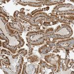 OFD1 Antibody in Immunohistochemistry (Paraffin) (IHC (P))