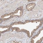 OFD1 Antibody in Immunohistochemistry (Paraffin) (IHC (P))