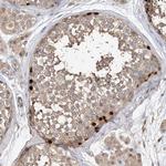 OFD1 Antibody in Immunohistochemistry (Paraffin) (IHC (P))