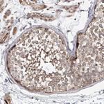 FRYL Antibody in Immunohistochemistry (Paraffin) (IHC (P))