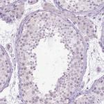 KMO Antibody in Immunohistochemistry (Paraffin) (IHC (P))