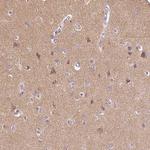 DNAJC6 Antibody in Immunohistochemistry (Paraffin) (IHC (P))