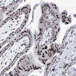 SART1 Antibody in Immunohistochemistry (Paraffin) (IHC (P))