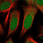 ZNF518B Antibody in Immunocytochemistry (ICC/IF)