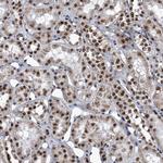 ZNF518B Antibody in Immunohistochemistry (Paraffin) (IHC (P))