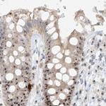 BYSL Antibody in Immunohistochemistry (IHC)