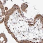 BYSL Antibody in Immunohistochemistry (IHC)