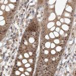 BYSL Antibody in Immunohistochemistry (IHC)