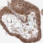 BYSL Antibody in Immunohistochemistry (IHC)