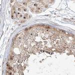 BYSL Antibody in Immunohistochemistry (IHC)