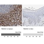 Thromboxane synthase Antibody