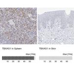 Thromboxane synthase Antibody in Immunohistochemistry (IHC)