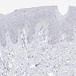 Thromboxane synthase Antibody in Immunohistochemistry (IHC)