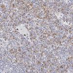 Thromboxane synthase Antibody in Immunohistochemistry (IHC)