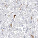 Thromboxane synthase Antibody in Immunohistochemistry (IHC)