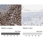 Thromboxane synthase Antibody in Immunohistochemistry (IHC)