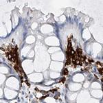 Thromboxane synthase Antibody in Immunohistochemistry (IHC)