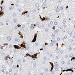 Thromboxane synthase Antibody in Immunohistochemistry (IHC)