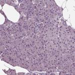 CLCN4 Antibody in Immunohistochemistry (IHC)