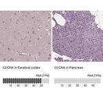 CLCN4 Antibody