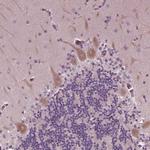 CLCN4 Antibody in Immunohistochemistry (IHC)