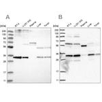 PPCS Antibody in Western Blot (WB)