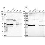 PPCS Antibody in Western Blot (WB)