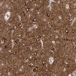 CPNE5 Antibody in Immunohistochemistry (Paraffin) (IHC (P))