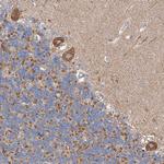 CPNE5 Antibody in Immunohistochemistry (Paraffin) (IHC (P))