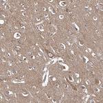 CPNE5 Antibody in Immunohistochemistry (Paraffin) (IHC (P))