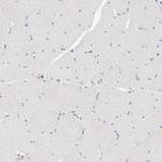 CPNE5 Antibody in Immunohistochemistry (Paraffin) (IHC (P))