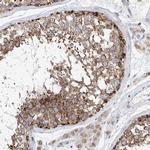 CPNE5 Antibody in Immunohistochemistry (Paraffin) (IHC (P))