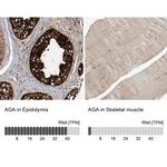 AGA Antibody in Immunohistochemistry (IHC)