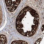 AGA Antibody in Immunohistochemistry (IHC)