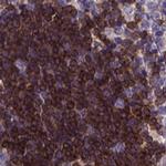 Themis Antibody in Immunohistochemistry (IHC)