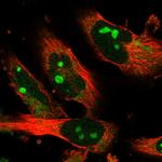 EXOC4 Antibody in Immunocytochemistry (ICC/IF)